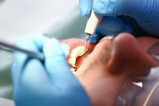 Best Walk-In Emergency Dental Services in Newton, IL